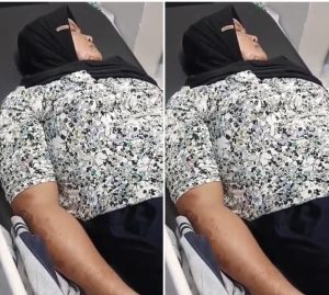 Pasutri di Palembang Jadi Korban Penyiraman Air Keras, Pelakunya Tetangga Sendiri, Langsung Kabur