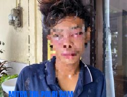 Apes ! Niat Curi Motor Malah Jatuh Tersenggol Truk Saat Larikan Motor Curian