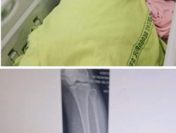 Diduga Ngantuk / Mabuk Anggota Patroli Lantas Polsek Pakal Surabaya Tabrak Pemotor Hingga Mengalami Patah Tulang 